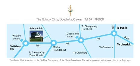 The map of Galway