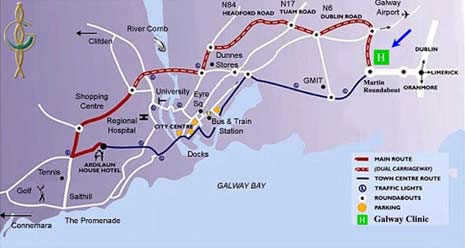 The map of Galway